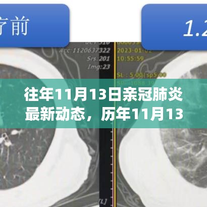 歷年11月13日新冠肺炎動態(tài)回顧，最新進(jìn)展、當(dāng)前動態(tài)與未來展望