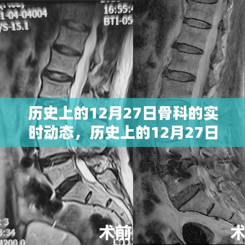 歷史上的骨科領(lǐng)域動態(tài)，聚焦十二月二十七日的實時進展概覽