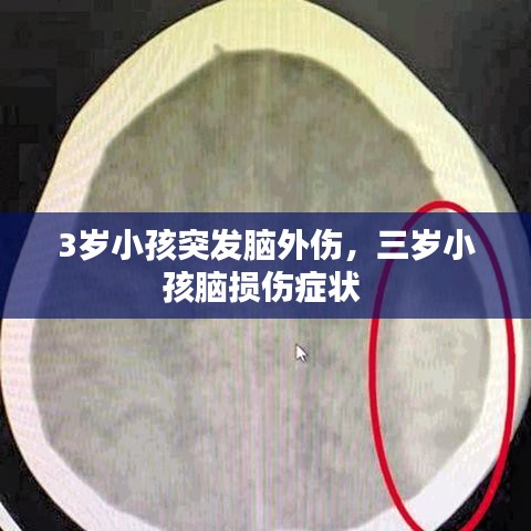 3歲小孩突發(fā)腦外傷，三歲小孩腦損傷癥狀 