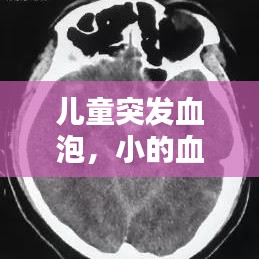 兒童突發(fā)血泡，小的血泡 