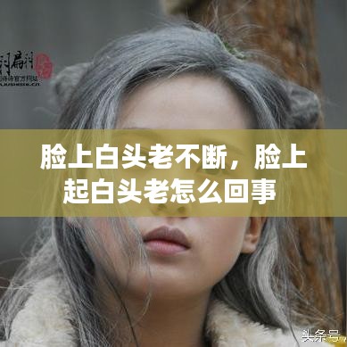 臉上白頭老不斷，臉上起白頭老怎么回事 