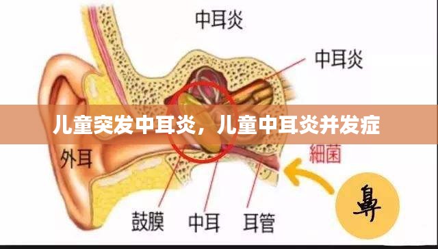 兒童突發(fā)中耳炎，兒童中耳炎并發(fā)癥 