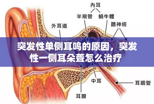 突發(fā)性單側(cè)耳鳴的原因，突發(fā)性一側(cè)耳朵聾怎么治療 